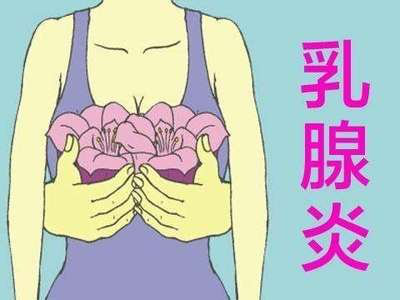 乳腺炎的預(yù)防